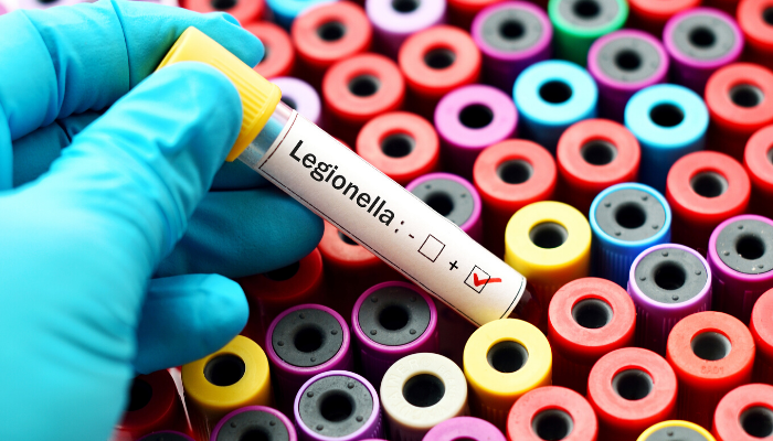 Legionella Test